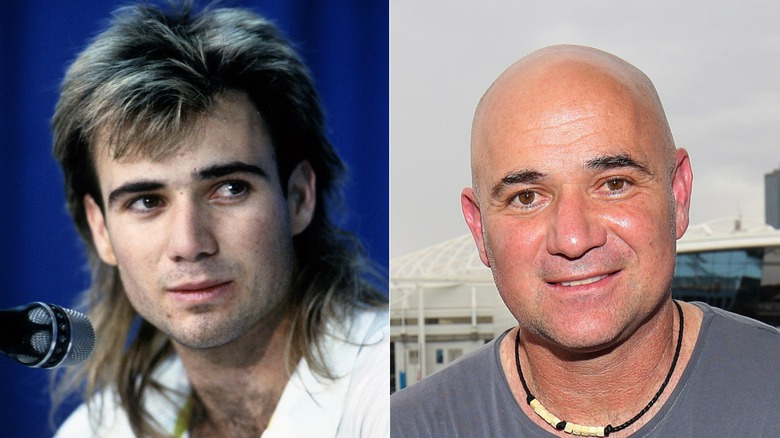   Andre Agassi s parmicí, plešatý