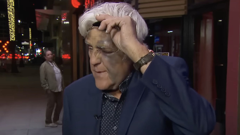 L'expert mèdic desmenteix per nosaltres els rumors virals sobre l'ull negre de Jay Leno