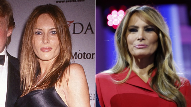   Melania Trump v letech 1999 a 2024